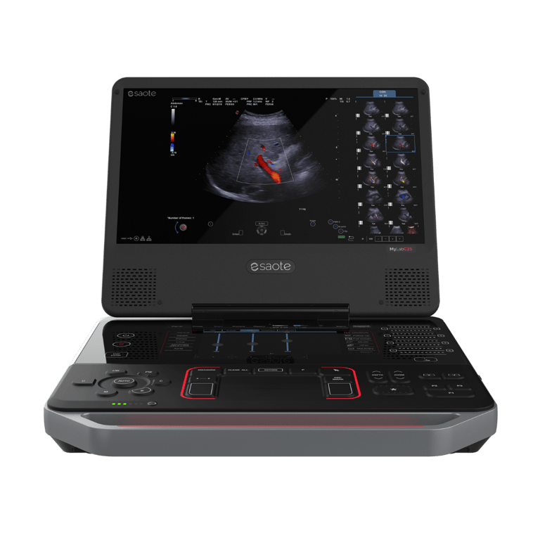 Esaote MyLab C25
