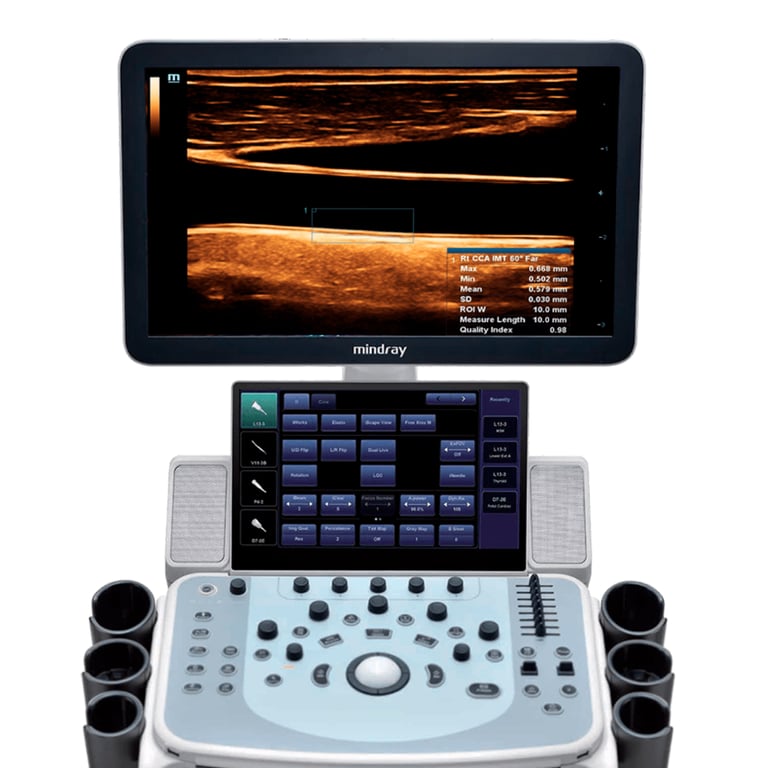 Mindray DC 60 klinisches Bildbeispiel ZST+