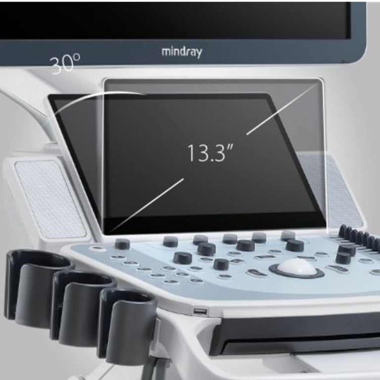 Mindray DC 60 Bedienfeld und 13,3-Zoll-Touchscreen