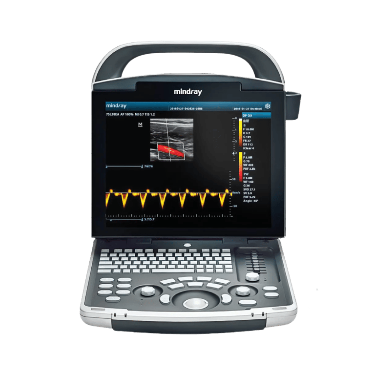 Mindray DP 10 mobiles Ultraschallgerät Basisdiagnostik