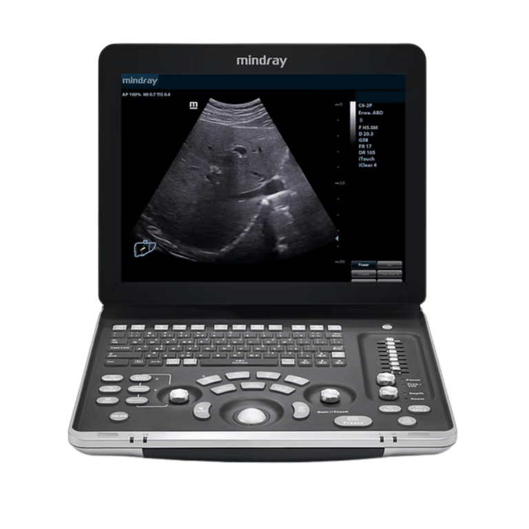 Mindray DP 30 mobiles Ultraschallgerät Basisdiagnostik