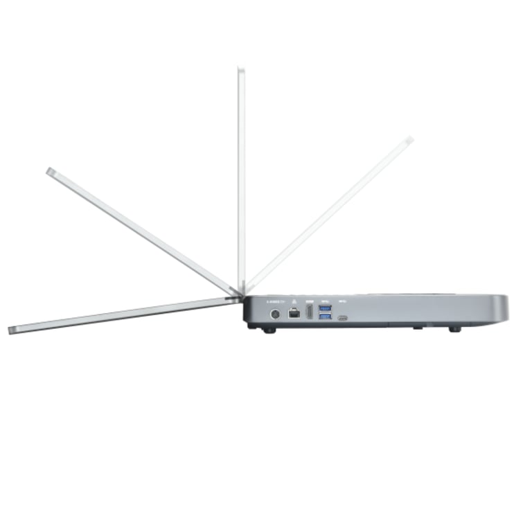 Mindray MX5 Bildbeispiel ZST+ Abdomen Sonographie