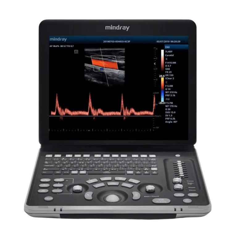 Mindray Z60 mobiles Ultraschallgerät Touchscreen